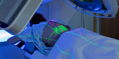 Radioterapia Conformacional 3D